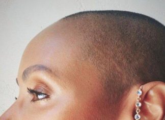 Kenali Penyakit Alopecia yang Diderita Istri Will Smith