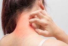 Menderita Alergi Parah Sampai Kulit Pipi Mengelupas, Tuhan Sembuhkan Seketika Lewat Healing From Heaven!